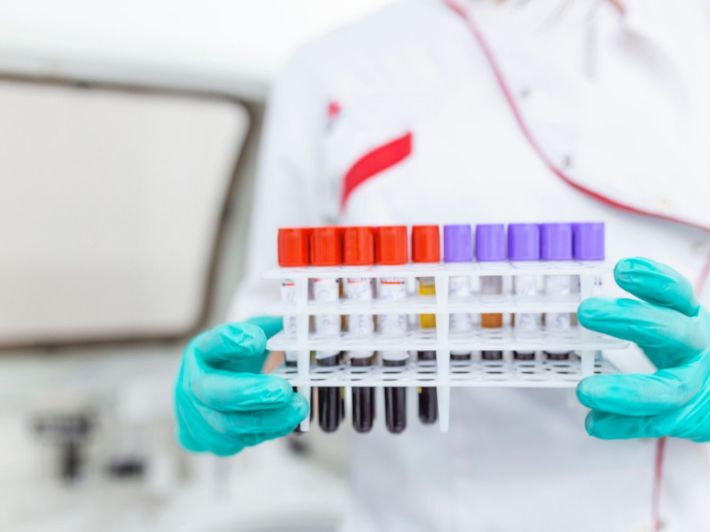 متى يكون ارتفاع الصفائح الدموية خطير؟