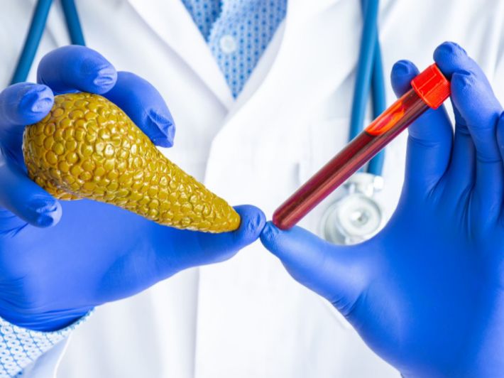 هل سرطان البنكرياس يظهر في تحليل الدم؟