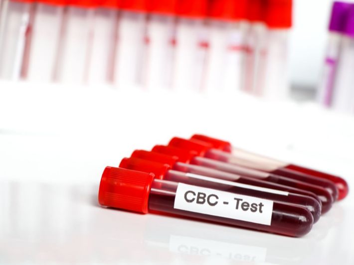 هل يكشف تحليل CBC عن وجود سرطان الغدد الليمفاوية؟