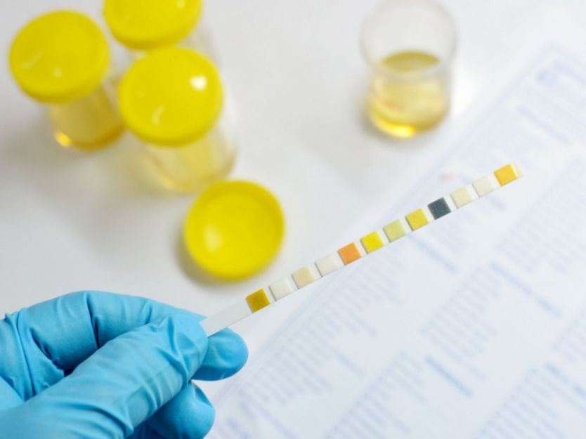 قراءة نتائج تحليل FSH و LH