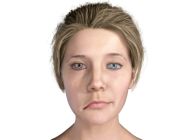 التهاب أعصاب الوجه: الأسباب والعلاج