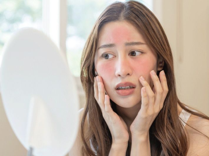 أطعمة تفاقم احمرار وحساسية الوجه