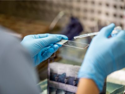 متى ولماذا يطلب الطبيب تحليل البلغم؟