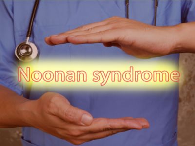 الوقاية من متلازمة نونان