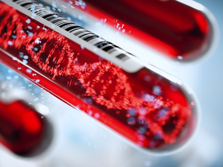 تشخيص متلازمة ويليام