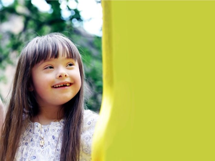 كم يعيش مريض متلازمة داون؟