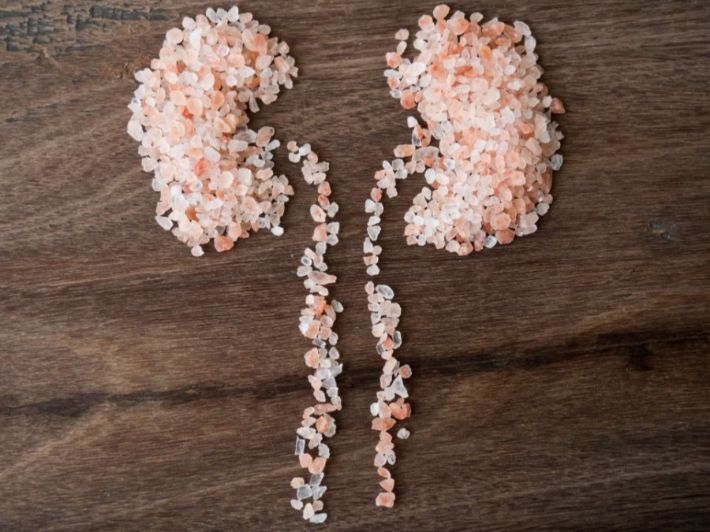 أعراض زيادة الأملاح في الكلى