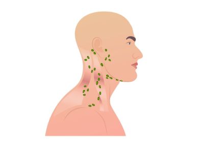 الفرق بين الغدة النكافية واللمفاوية